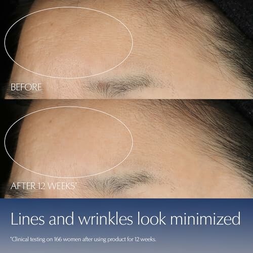 Comparison of skin before and after 12 weeks showing reduced lines and wrinkles.