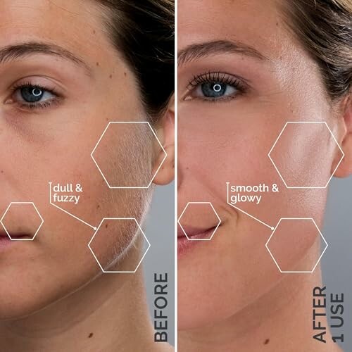 Before and after skincare comparison showing skin texture and glow.