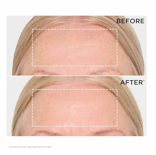 Comparison of forehead before and after skincare treatment.