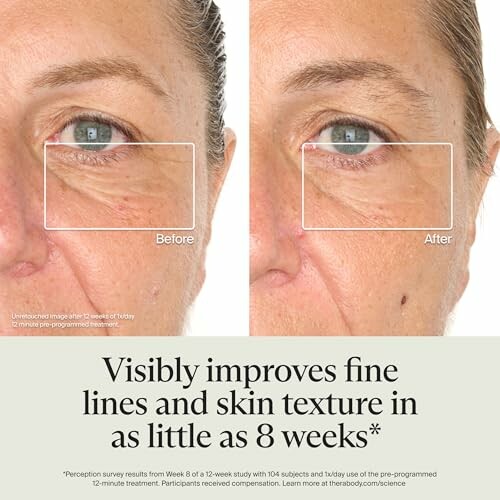 Comparison of skin texture before and after 8-week treatment