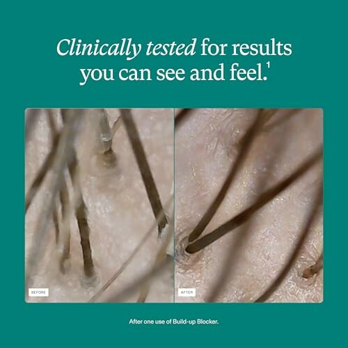 Close-up comparison of scalp and hair before treatment.