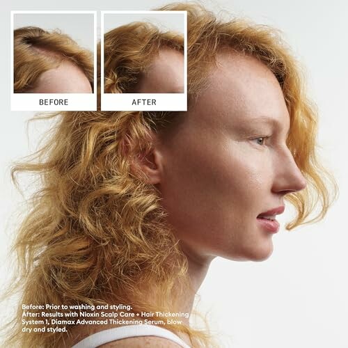 Side profile of a person showing hair thickening results with before and after images.