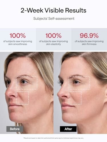 Before and after images showing 2-week skin improvement results.