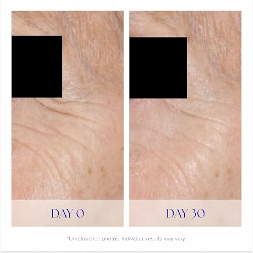 Comparison of skin on Day 0 and Day 30, showing visible improvement.