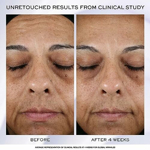 Before and after results of skin treatment from clinical study.