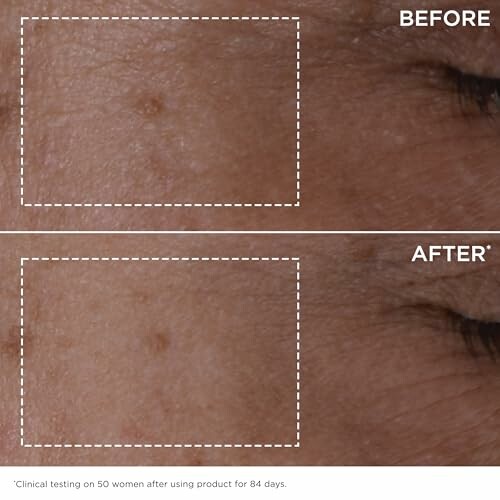 Close-up of skin before and after treatment