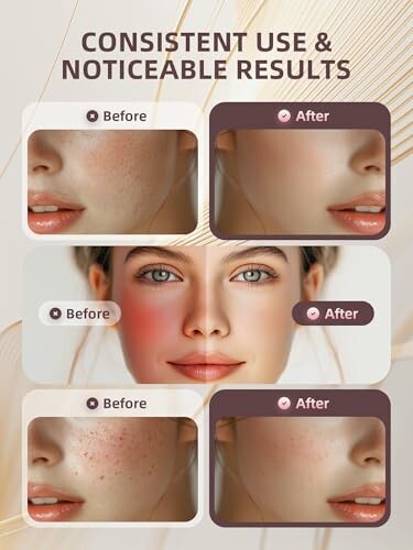 Comparison of facial skin before and after skincare treatment showing noticeable improvements.