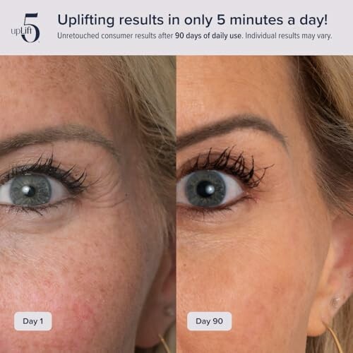 Before and after skin care results over 90 days.