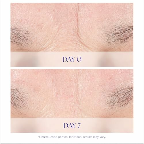 Comparison of skin texture on Day 0 and Day 7.